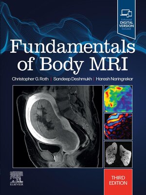 cover image of Fundamentals of Body MRI E-Book